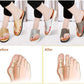 Chic Comfort: Correcting Zomersandalen